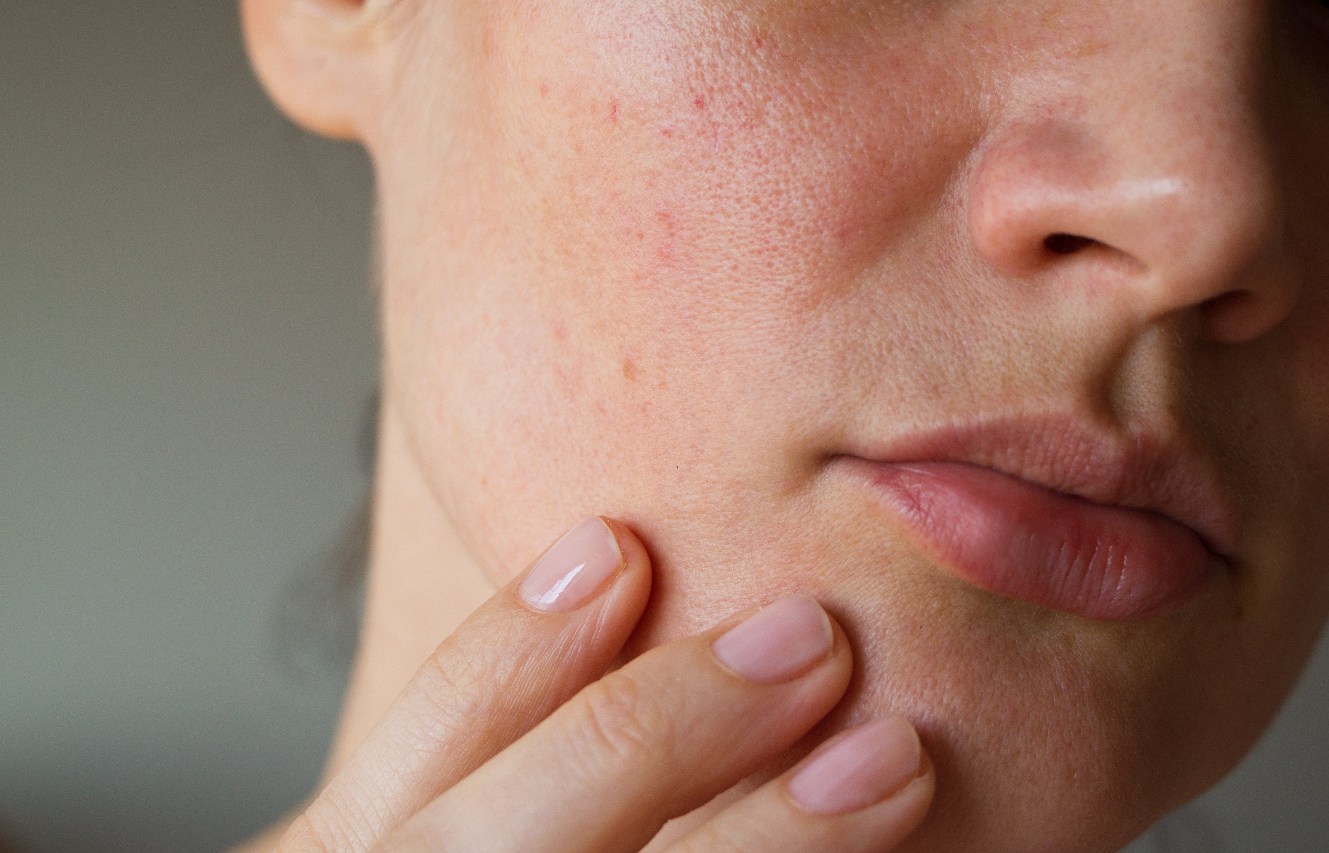 dry skin causes