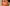 Understanding Pigmentation: What Really Works? A Science-Backed Guide to Fading Dark Spots - Pure Alchemy