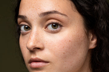 Skin Pigmentation: Triggers, Types, and Treatments